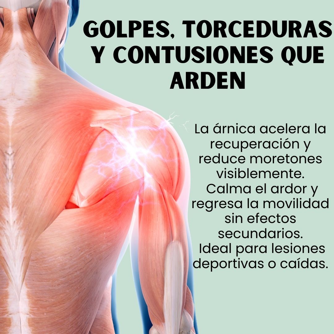 POMADA MUSCULAR DE ARNICA® CON DICLOFENACO Y NAPROXENO
