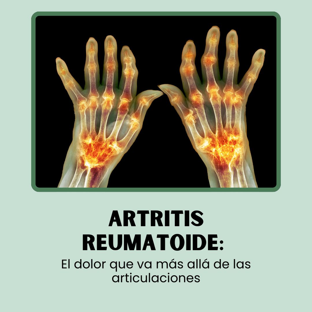 POMADA MUSCULAR DE ARNICA® CON DICLOFENACO Y NAPROXENO