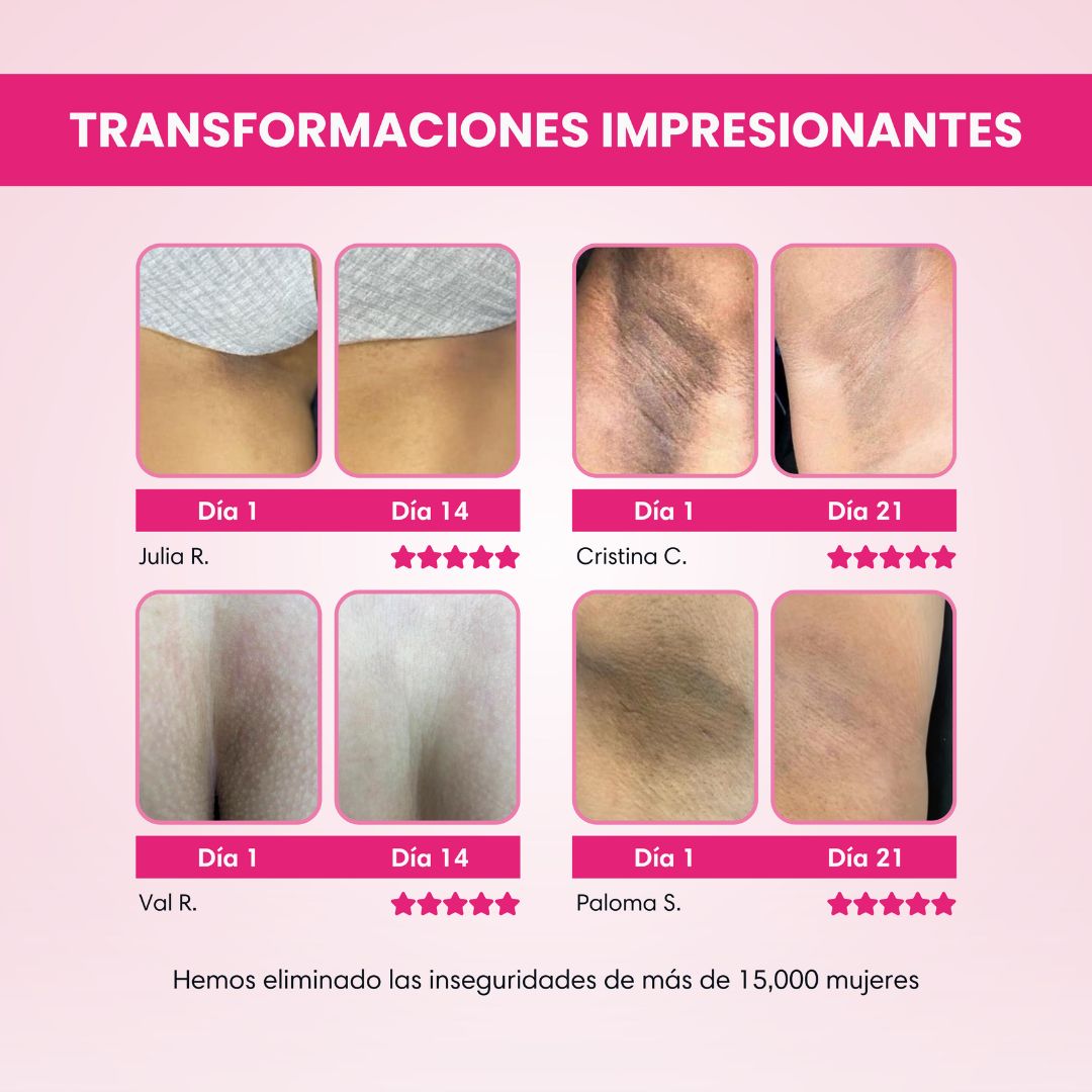 SKIN GLOW® CREMA ACLARANTE