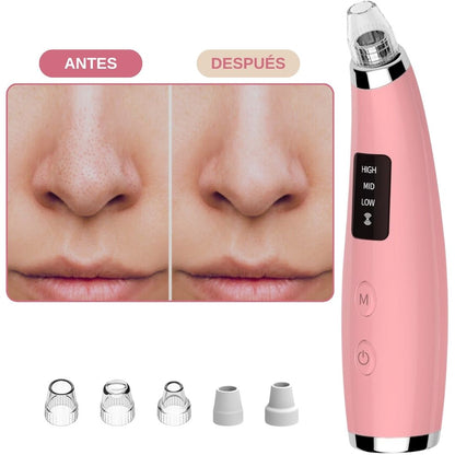 EXTRACTOR DE ESPINILLAS Y PUNTOS NEGROS®