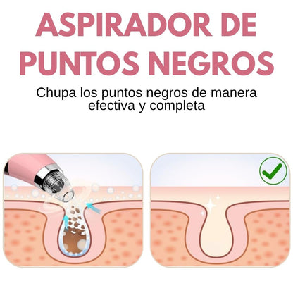 EXTRACTOR DE ESPINILLAS Y PUNTOS NEGROS®