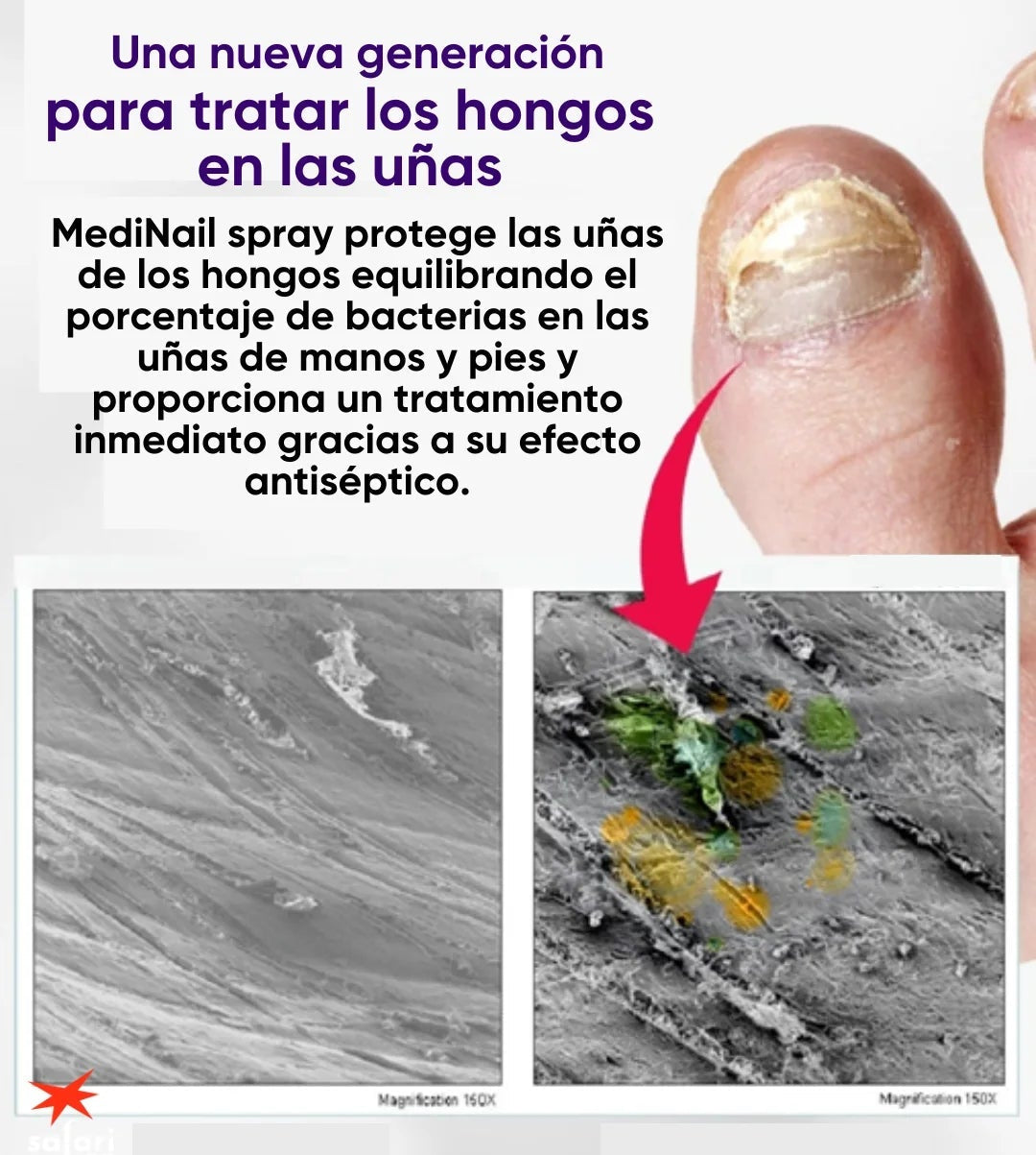 MEDINAIL™ -"ADIÓS A LOS HONGOS: ENCUENTRA EL ELIMINADOR IDEAL" Elimina los hongos en las uñas de forma rápida y efectiva