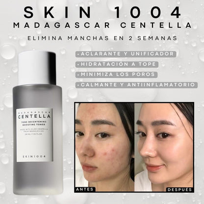 SKIN1004 Madagascar Centella