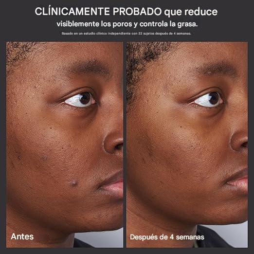 PAULA'S CHOICE® Skin Perfecting - Exfoliante líquido de ácido glicolico y ácido salicílico BHA al 2%